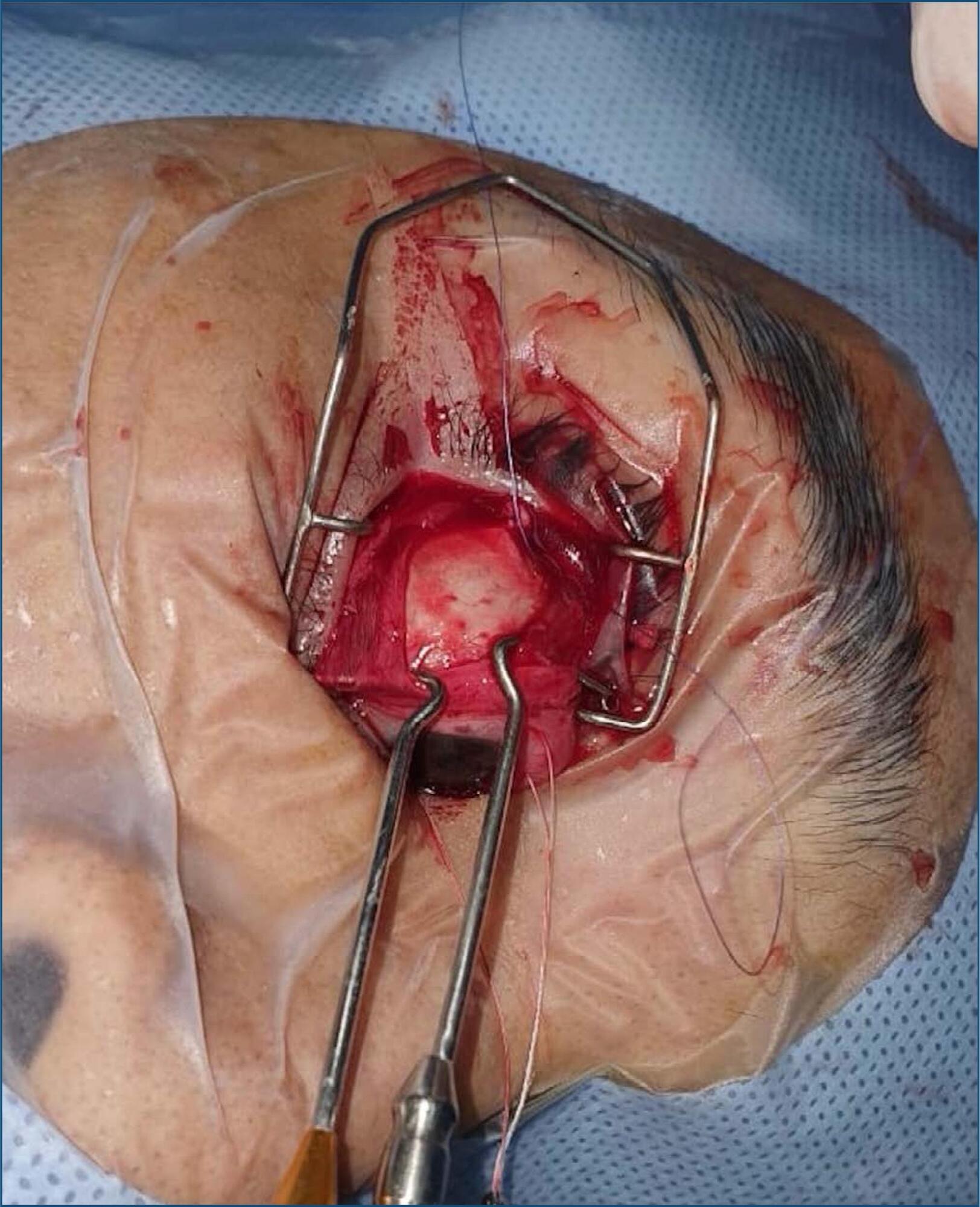 Revista Brasileira de Oftalmologia